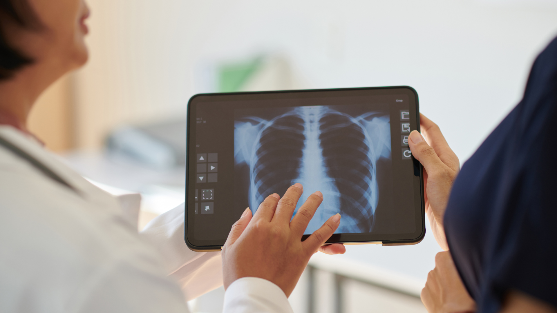 Doctor reviewing a chest X-ray during a lung cancer risk consultation.