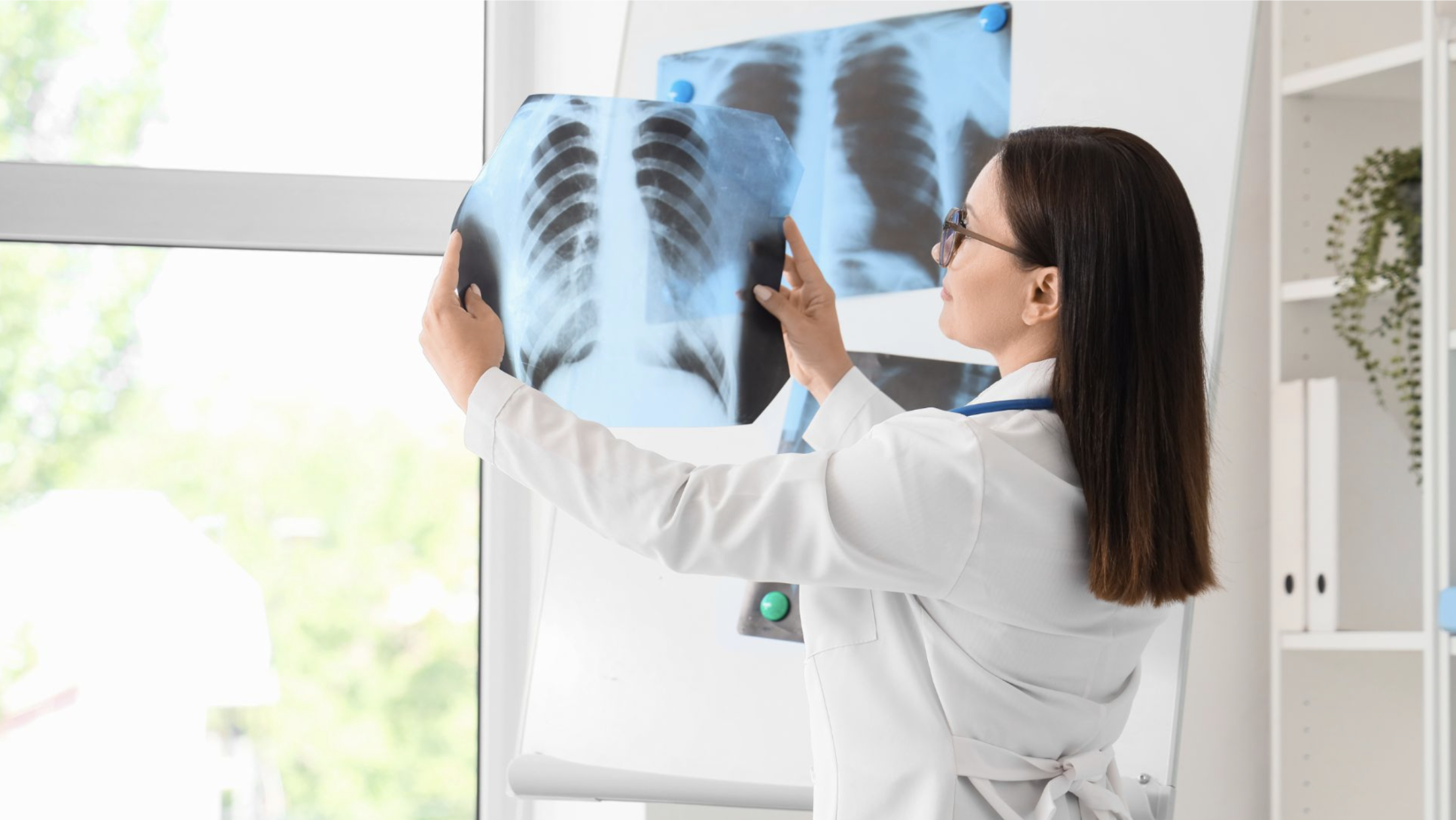 Doctor reviewing a chest X-ray as part of a lung health assessment.
